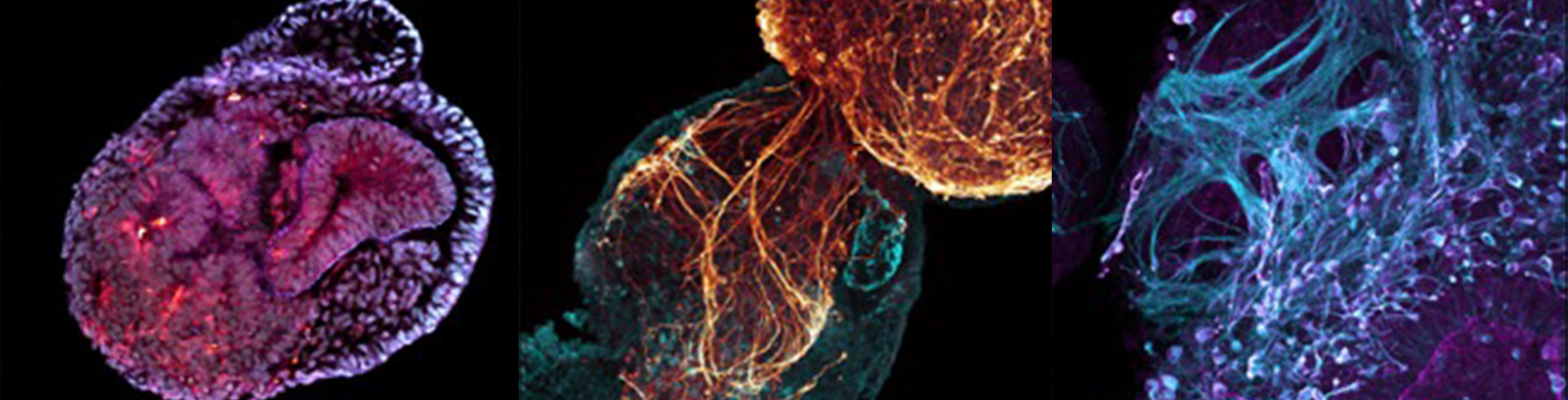 Human hiPSC EMLO Gastruloids (Cox2, Gata4, Tuj1); (Gata4, Tuj1); (MOR, Tuj1)