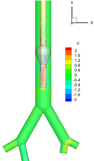 Trachea
