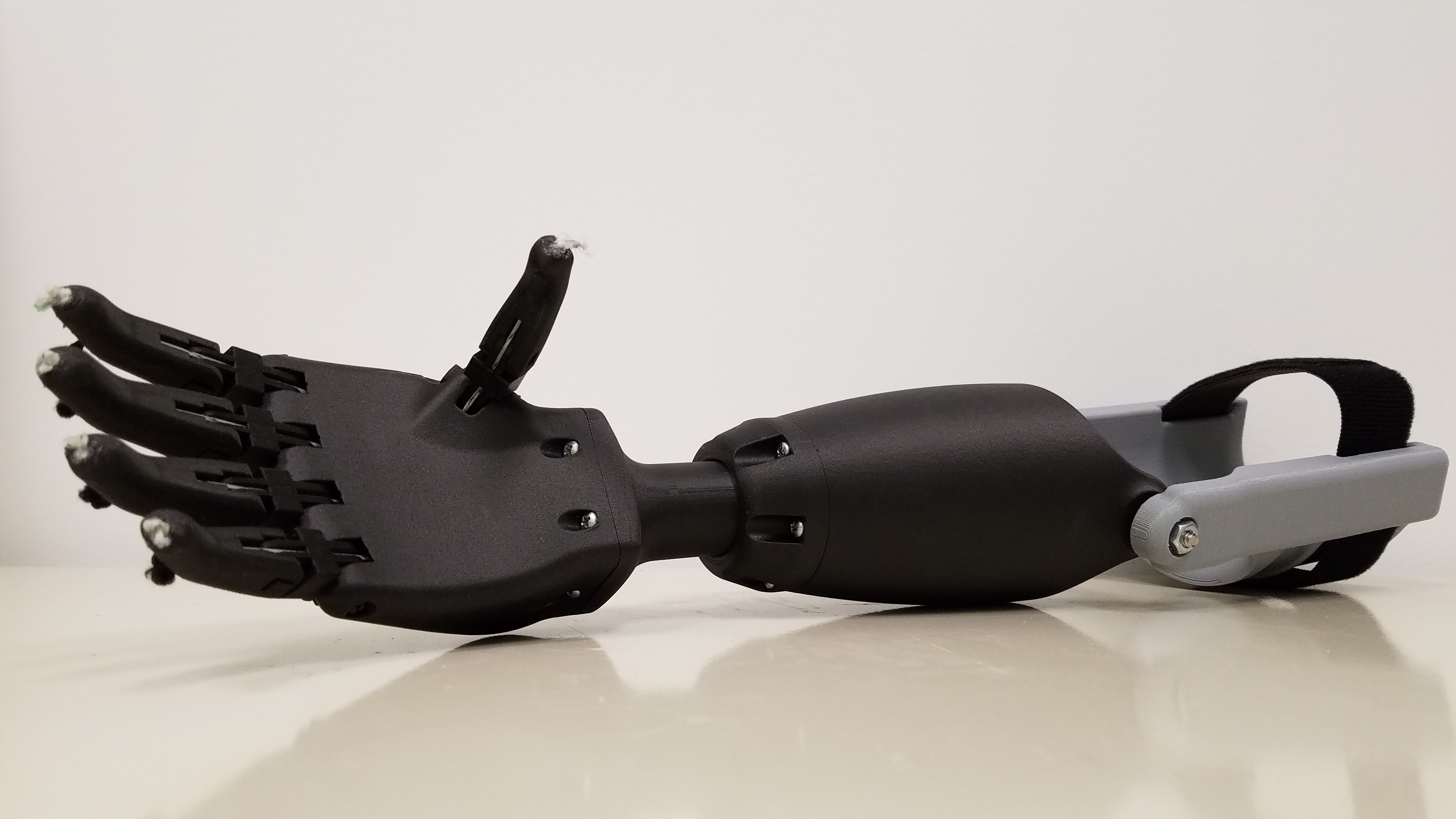 prosthetic hand 3D print