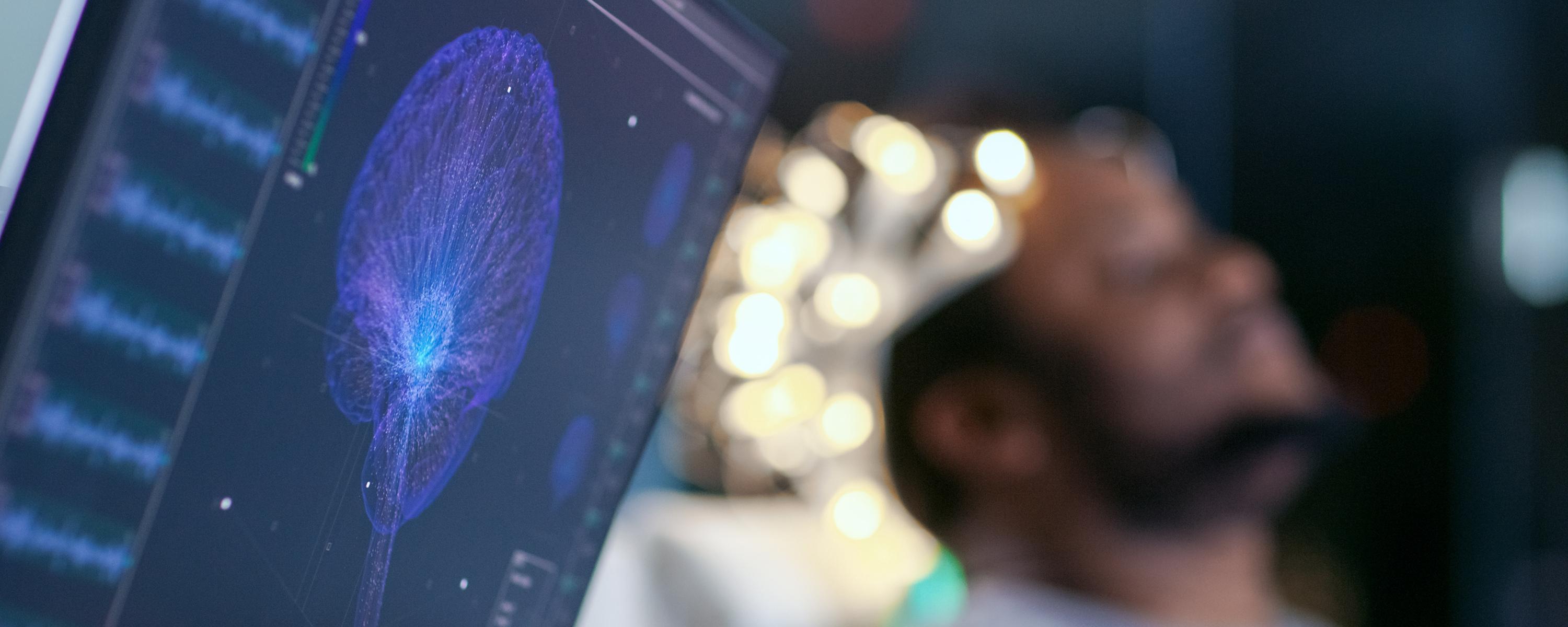 Image of a man getting a brain scan