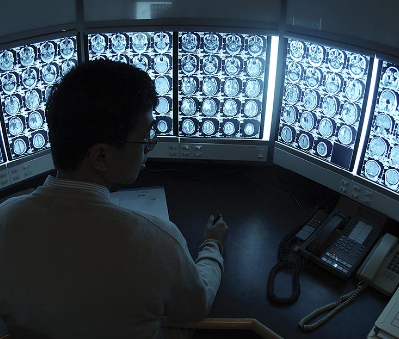 Illustrative photo of person looking at scansHealth Information Management