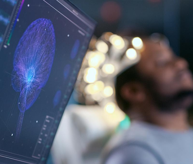 image of a man getting a brain scan